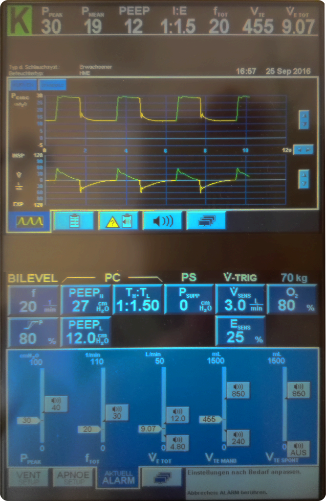 Monitor Beatmungsgerät