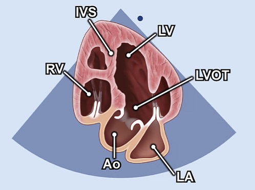 apikaler Fuenfkammerblick.png